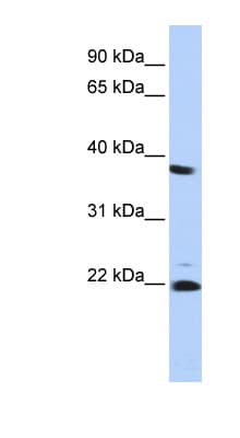 Polyclonal Rabbit anti-Human PSMB2 Antibody (aa107-156, WB)