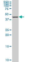 Monoclonal Mouse anti-Human Nor-1 / NR4A3 Antibody (clone 1E9, IF, WB)