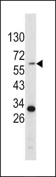 Polyclonal Rabbit anti-Human Tyrosinase Antibody (aa486-513, IHC, IF, WB)