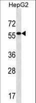 ALDH3B2 Antibody (aa252-280)