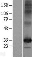 SLC35F6 Protein (Over-Expression Lysate Myc-DDK (Flag))