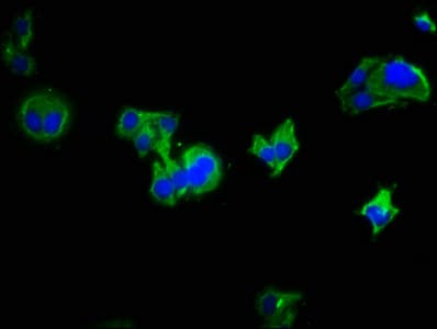 Polyclonal Rabbit anti-Human LRRC19 Antibody