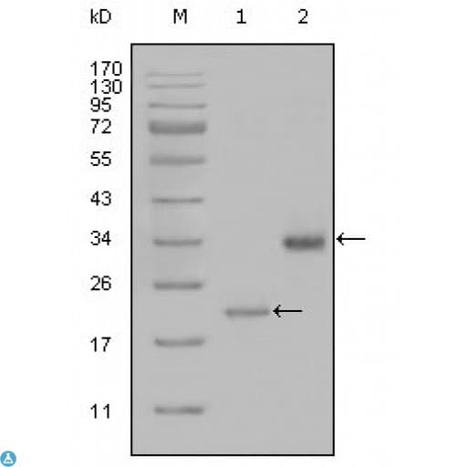 Monoclonal Mouse anti-Human LPA / Lipoprotein a Antibody (IHC, WB)