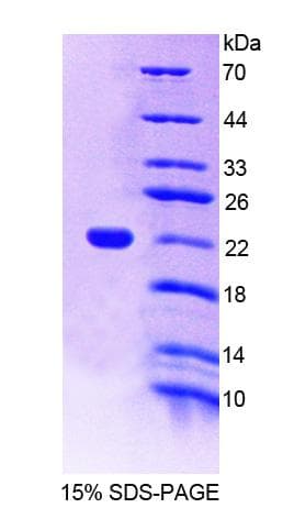 Mouse A4GALT Protein (Recombinant His-T7)