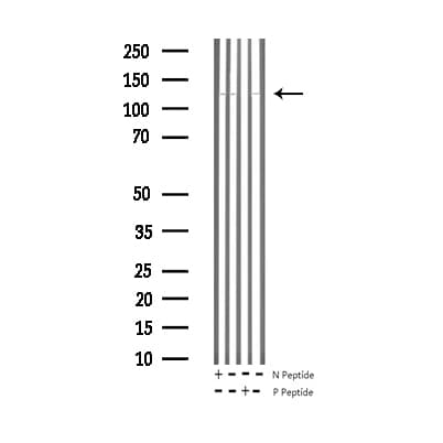 Polyclonal Rabbit anti-Human NOS3 / eNOS Antibody (phospho-Thr494, IF, WB)