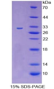 Rat CD109 Protein (Recombinant His-T7)