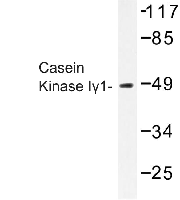 CSNK1G1 / CKI-Gamma 1 Antibody (His3)