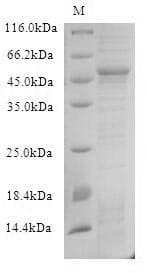 Human UL49 Protein (Recombinant 6His-B2M, N-terminus)