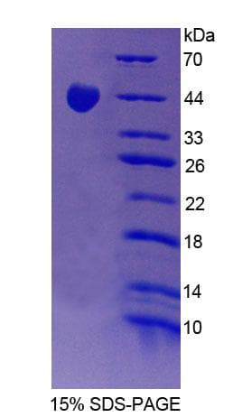 Mouse TROVE2 Protein (Recombinant His-T7, N-terminus)