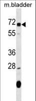 OSGIN1 Antibody (aa483-510)