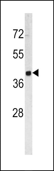 Polyclonal Rabbit anti-Human TROP2 / TACSTD2 Antibody (aa162-190, IHC, WB)