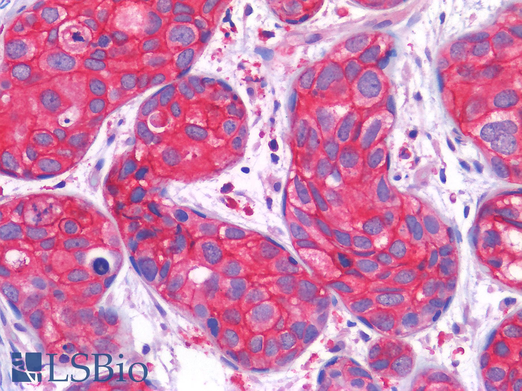 PathPlus™ ERBB2 / HER2 Antibody (clone AHC0142)