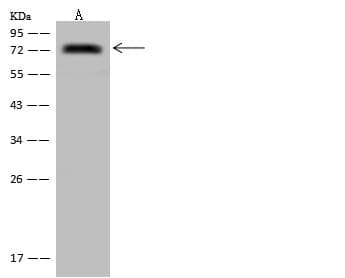 Polyclonal Rabbit anti-Human LY9 / CD229 Antibody (IHC, WB)