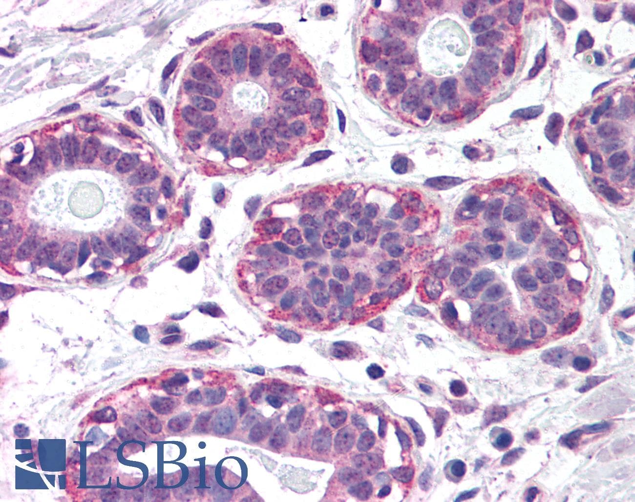 PathPlus™ NET1 / ARHGEF8 Antibody (aa396-409)