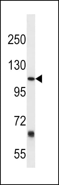 PTGFRN Antibody (aa458-485)