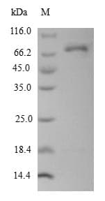 Human DCT / Dopachrome Tautomerase Protein (Recombinant 10His-SUMO, N-terminus + Myc, C-terminus)