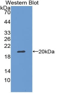 NOS2 / iNOS Antibody (aa530-693, APC)