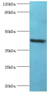 GOLM1 / GP73 / GOLPH2 Antibody (aa112-401)