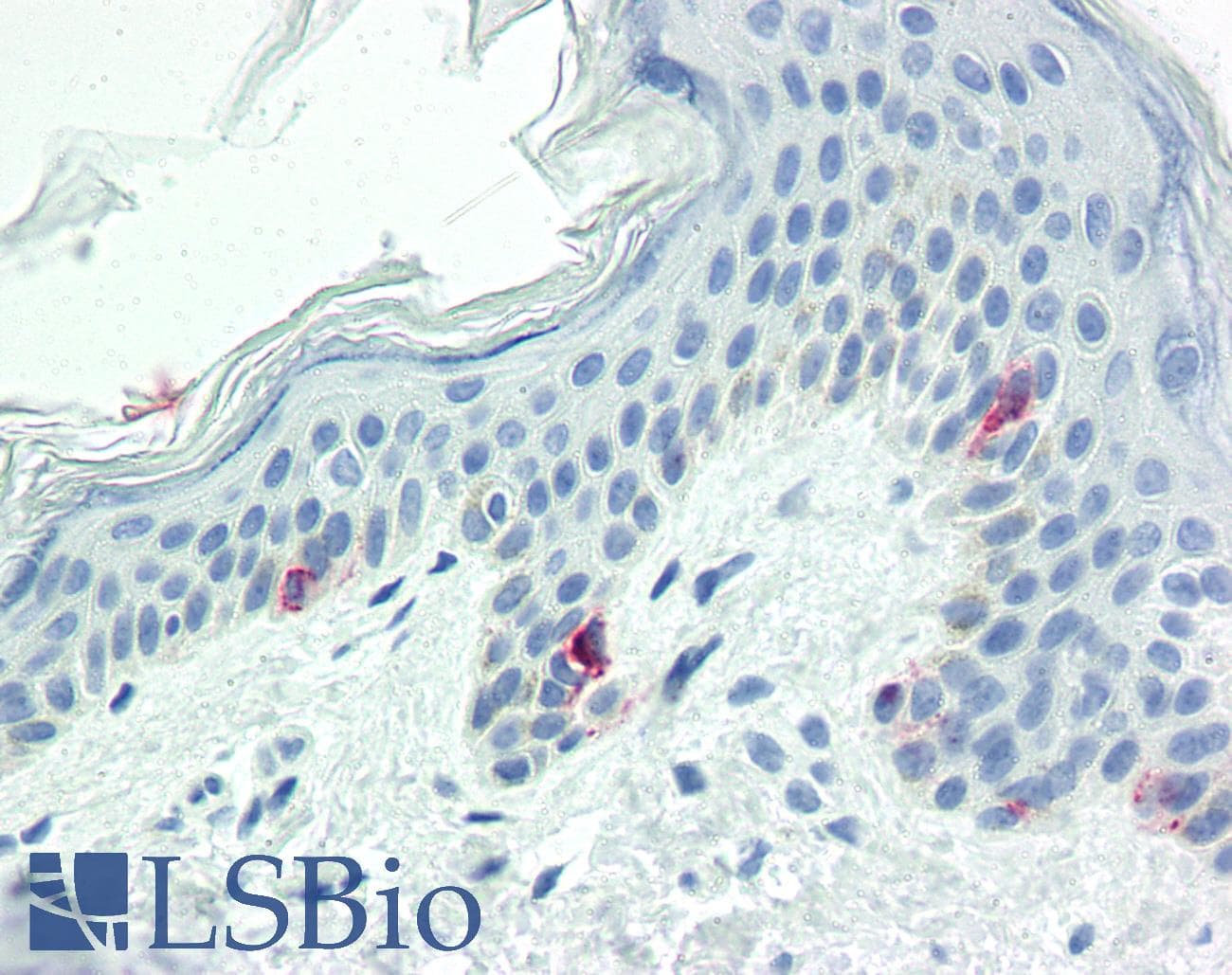 PathPlus™ Tyrosinase Antibody (clone T311)