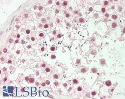 IHC-plus™ Polyclonal Rabbit anti-Human ZHX2 / RAF Antibody (C-Terminus, IHC, WB)