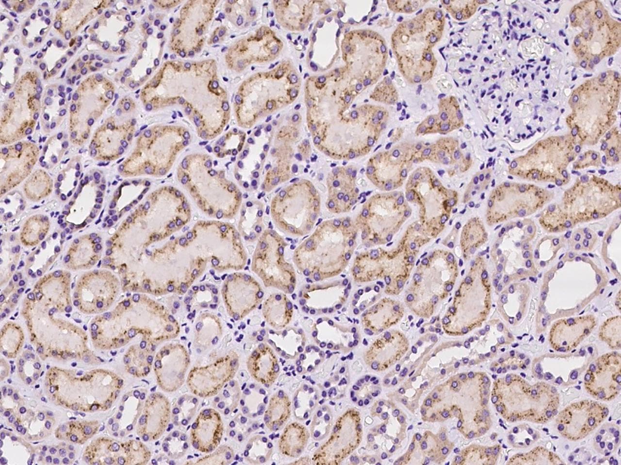 Polyclonal Rabbit anti-Human TSPAN1 / TM4SF Antibody (IHC)