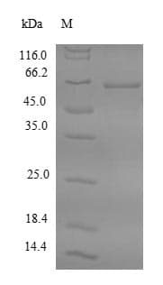 Human FDPS Protein (Recombinant 6His-SUMO, N-terminus)