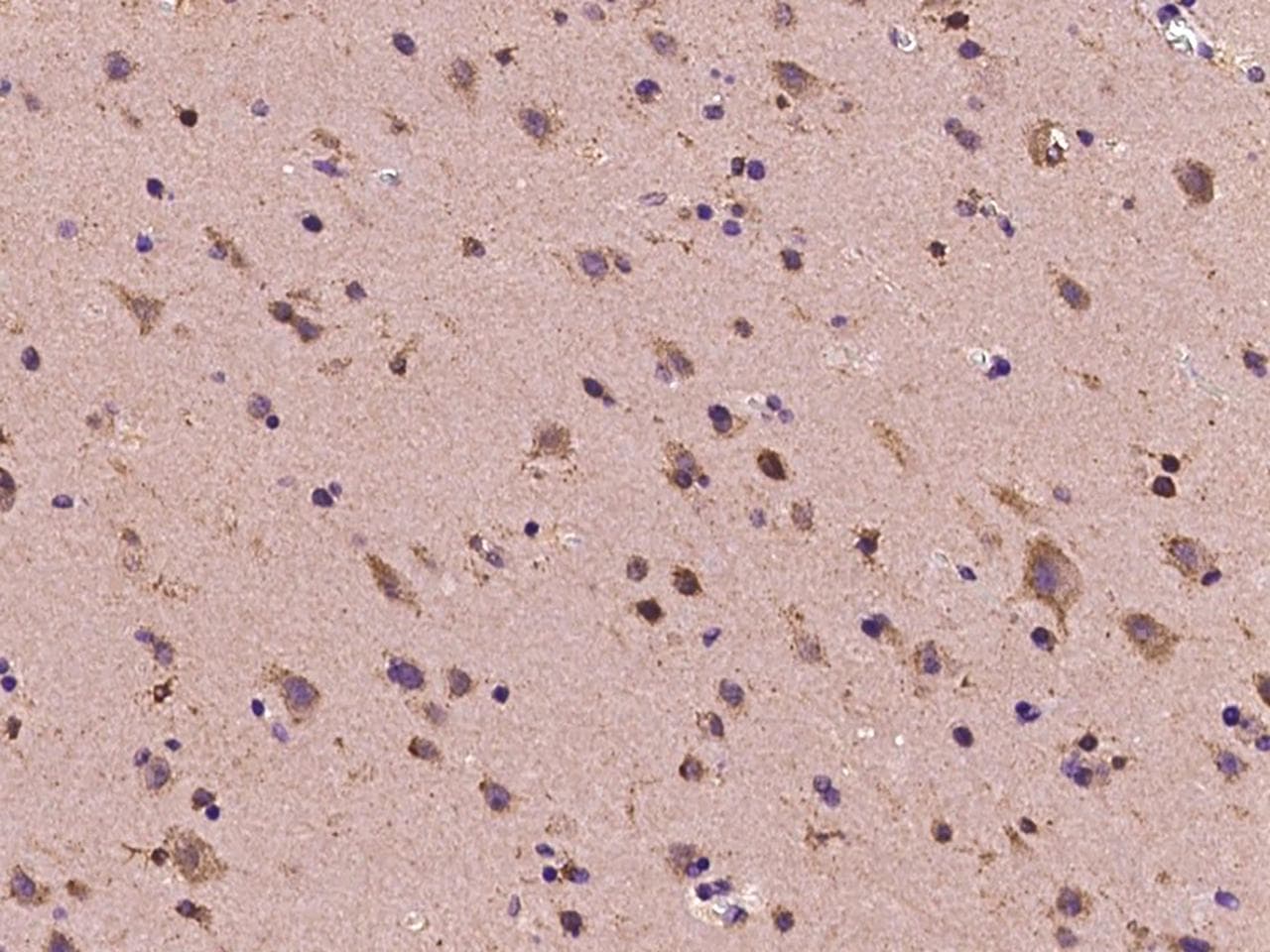 DYDC1 Antibody