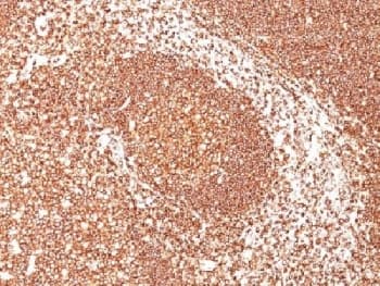 CD45 / LCA Antibody (clone PTPRC/1461)