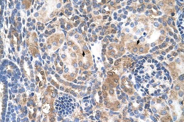 Mineralocorticoid Receptor Antibody (aa651-700)
