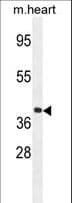 GNA15 Antibody (aa333-361)