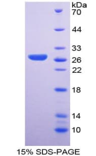 Human SOX2 Protein (Recombinant His-T7)