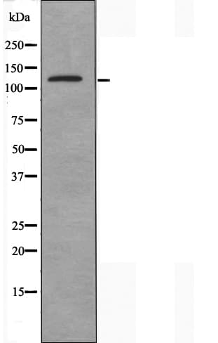 SYNE3 / C14orf49 Antibody