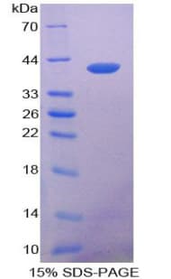 KRT14 / CK14 / Cytokeratin 14 Protein (Recombinant His-T7)