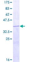 Human HRH4 / Histamine H4 Receptor Protein (Recombinant GST, N-terminus)