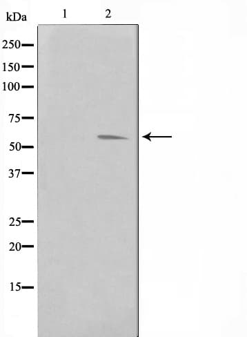 PIM1 / Pim-1 Antibody
