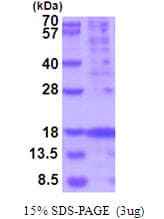 Human TSLP Protein (Recombinant His)