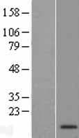 Human C9orf170 Protein (Over-Expression Lysate Myc-DDK (Flag))