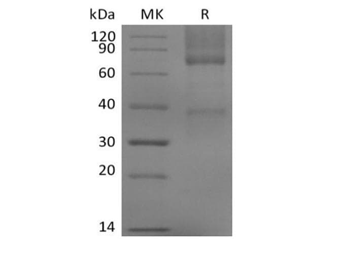 Mouse GPC3 / Glypican 3 Protein (Recombinant 6His, C-terminus)