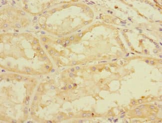 PDE4DIP / MMGL Antibody