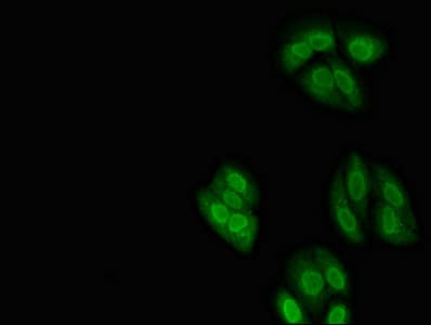 NXF1 / TAP Antibody