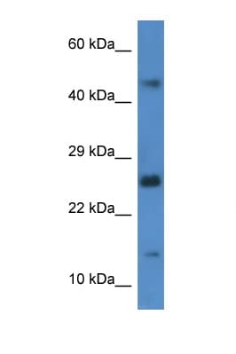 Polyclonal Rabbit anti-Rat GABARAPL2 / ATG8 Antibody (C-Terminus, WB)