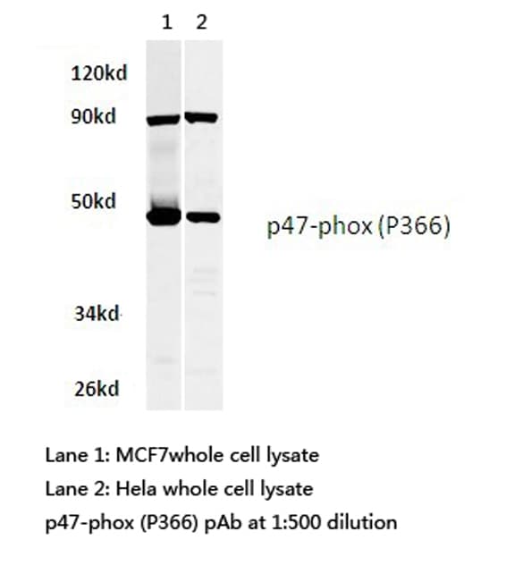 NCF1 / p47phox / p47 phox Antibody (Pro366)