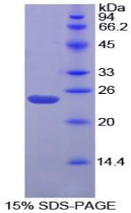 Chicken GREM1 / Gremlin-1 Protein (Recombinant His-S)