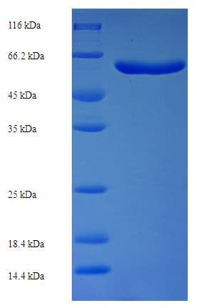E. coli FtsZ Protein (Recombinant His-SUMO)