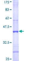 Human Complement C4b Protein (Recombinant GST, N-terminus)