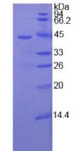 Human Complement C3 Protein (Recombinant His-S)
