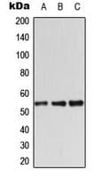 Polyclonal Rabbit anti-Human STK11 / LKB1 Antibody (Internal, WB)