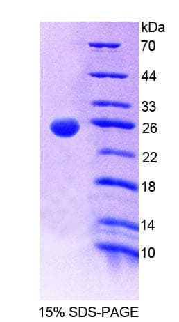 Mouse GCL / Grancalcin Protein (Recombinant His-T7)