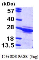 Human CYGB / Cytoglobin Protein (Recombinant His)