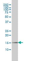 PIN1 Antibody (clone 2F2)